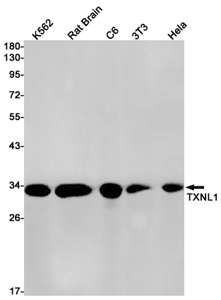 Thioredoxin Like Protein 1