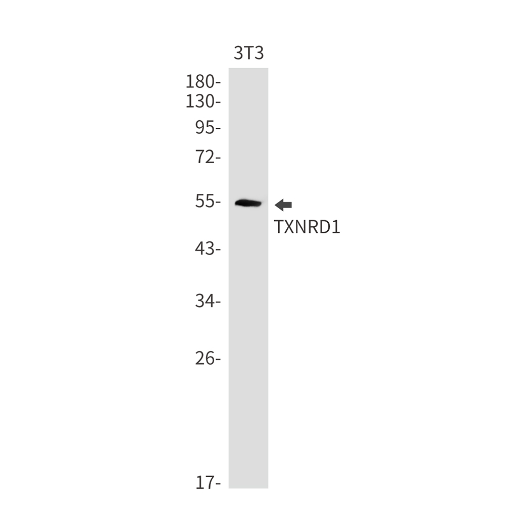 Thioredoxin Reductase 1