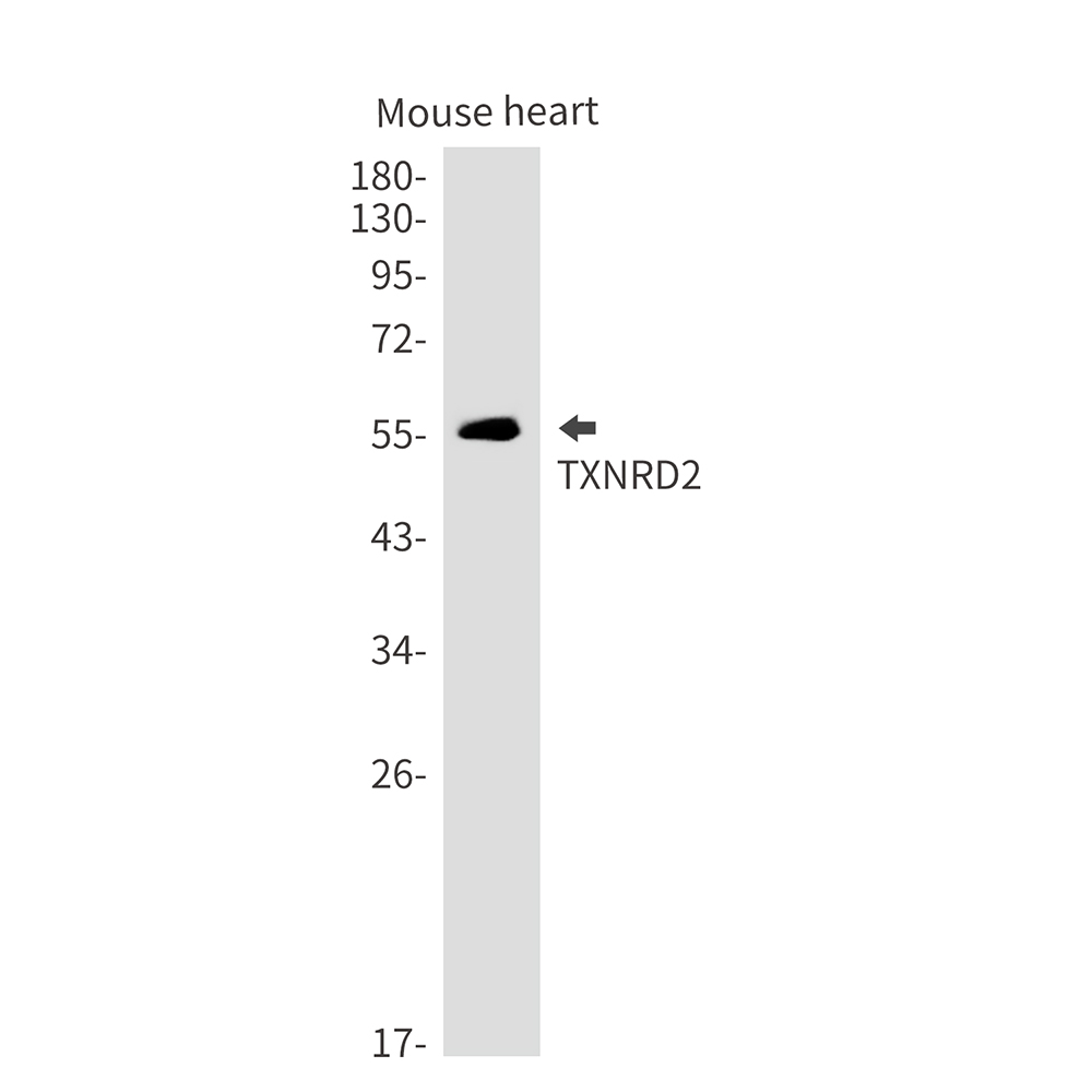 Thioredoxin Reductase 2