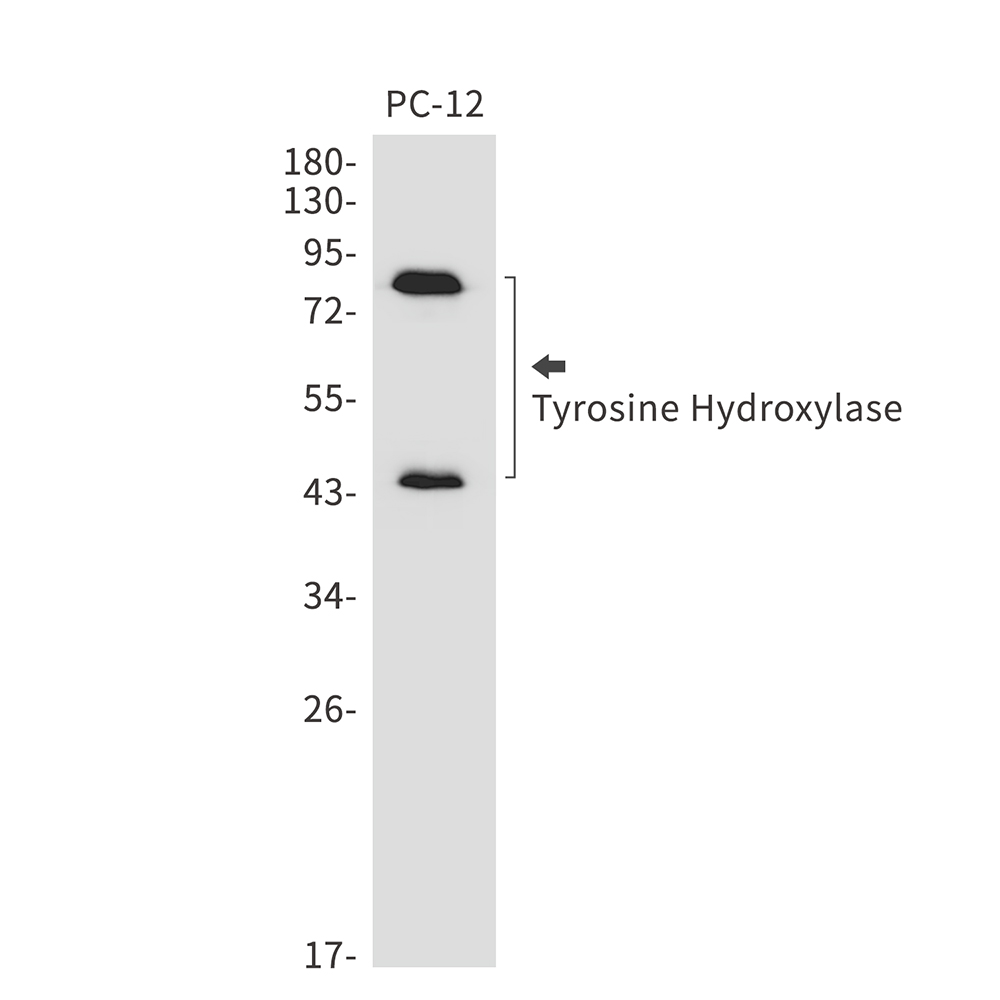 Tyrosine Hydroxylase