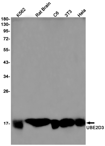 Ubiquitin Conjugating Enzyme E2 D3