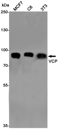 VCP
