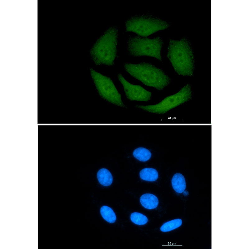 Rabbit Monoclonal Antibody to VCP