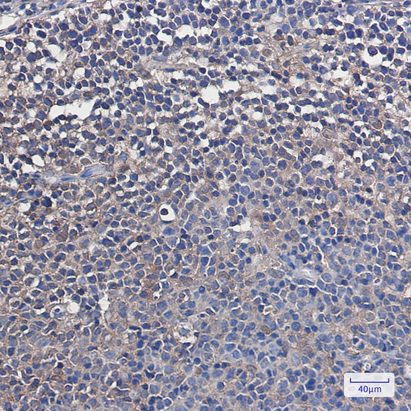 Rabbit Monoclonal Antibody to VCP