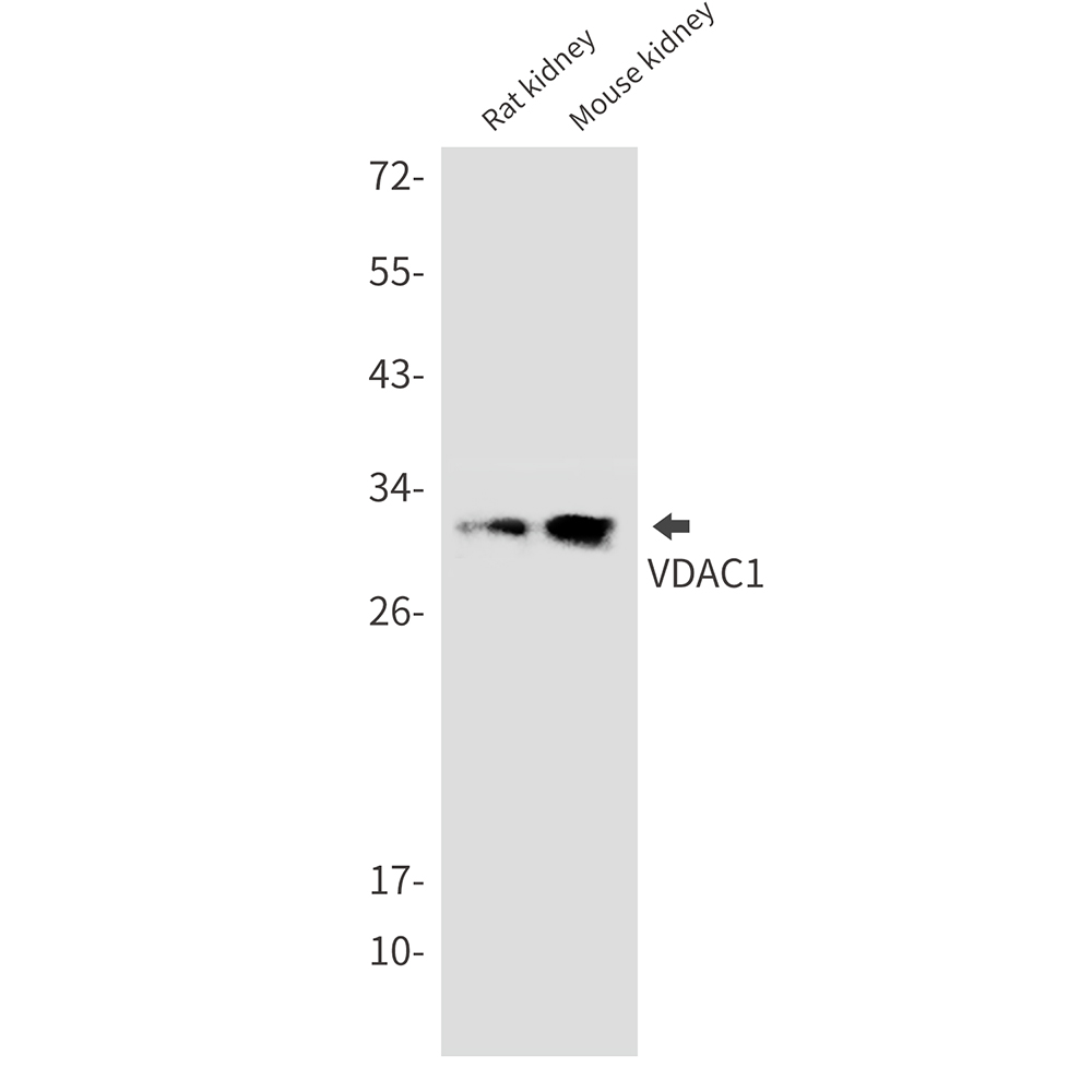 VDAC1
