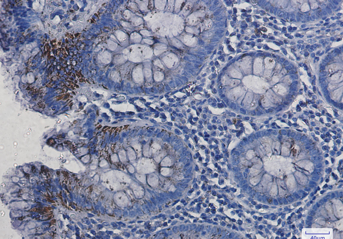Rabbit Monoclonal Antibody to VDAC1
