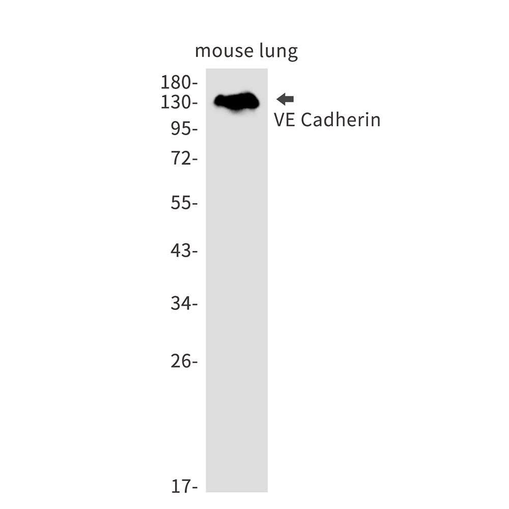 Cadherin 5