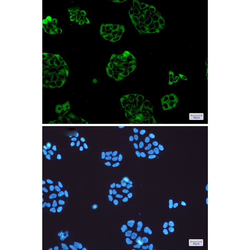 Rabbit Monoclonal Antibody to Vinculin