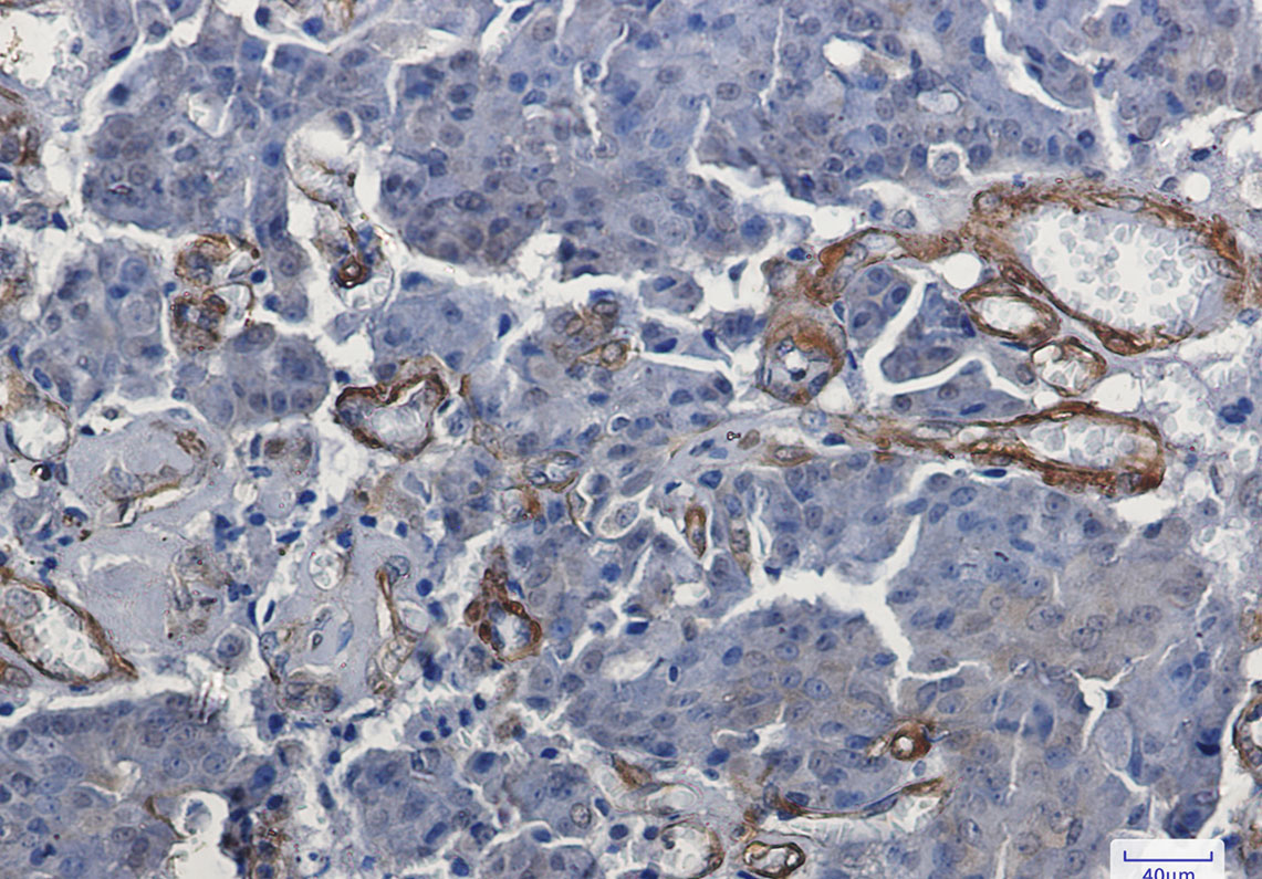 Rabbit Monoclonal Antibody to Vinculin