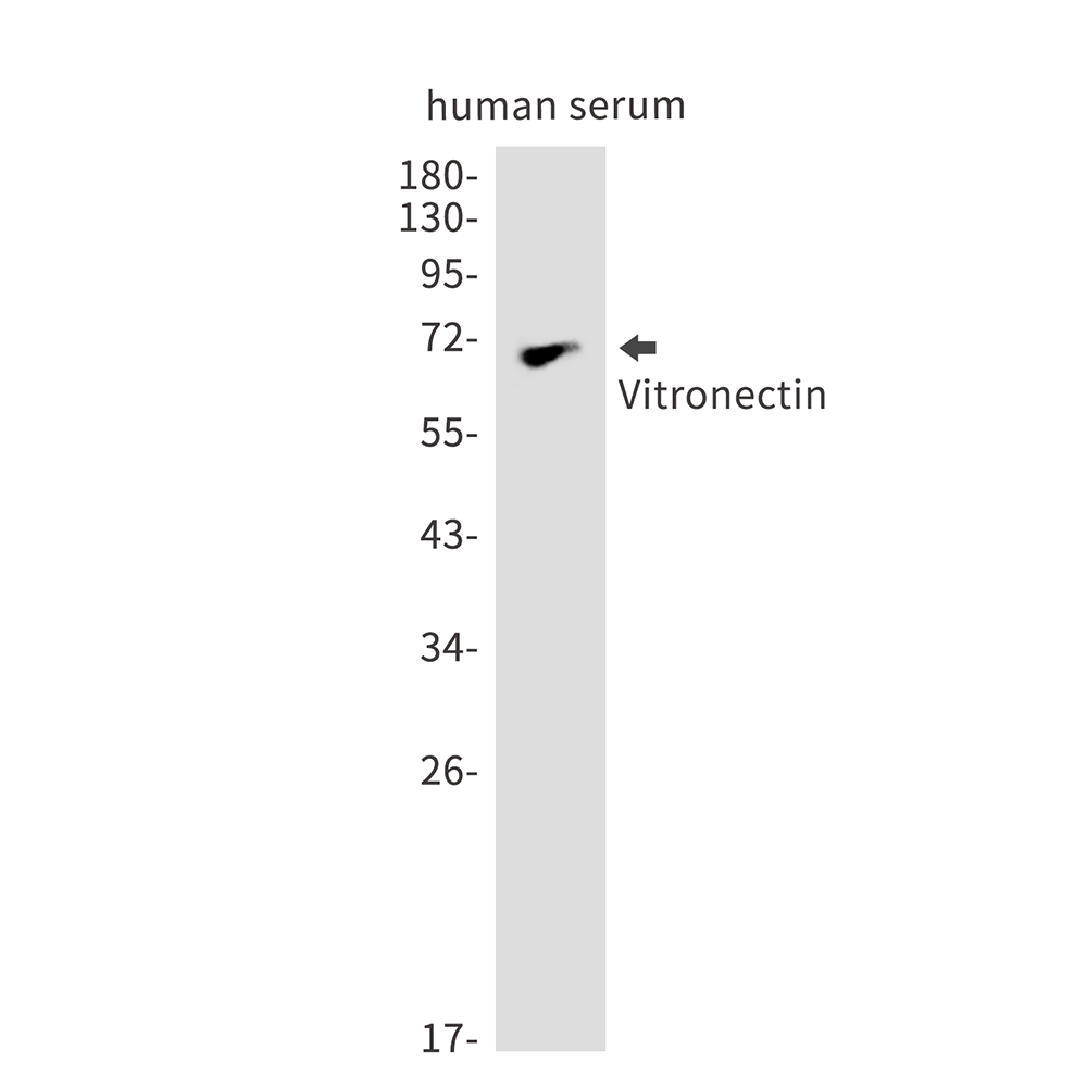 Vitronectin