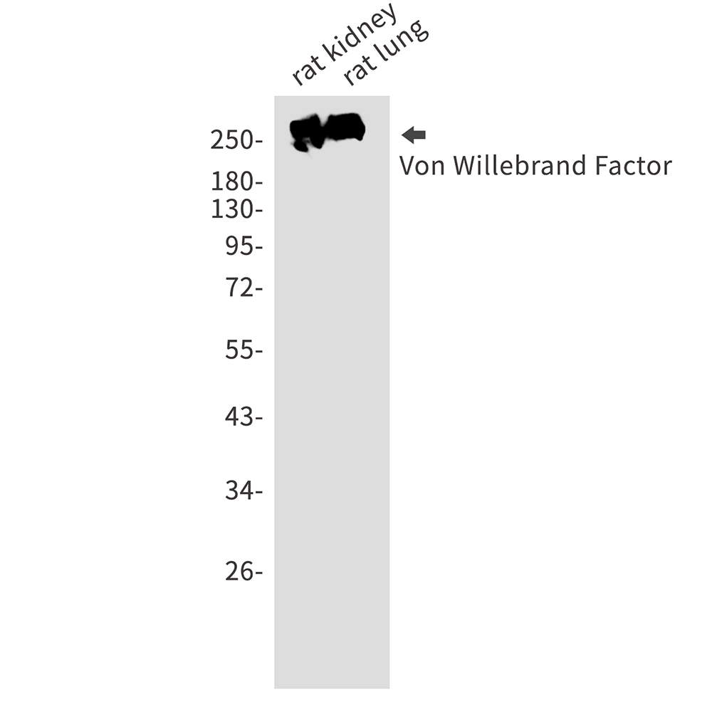 von Willebrand Factor