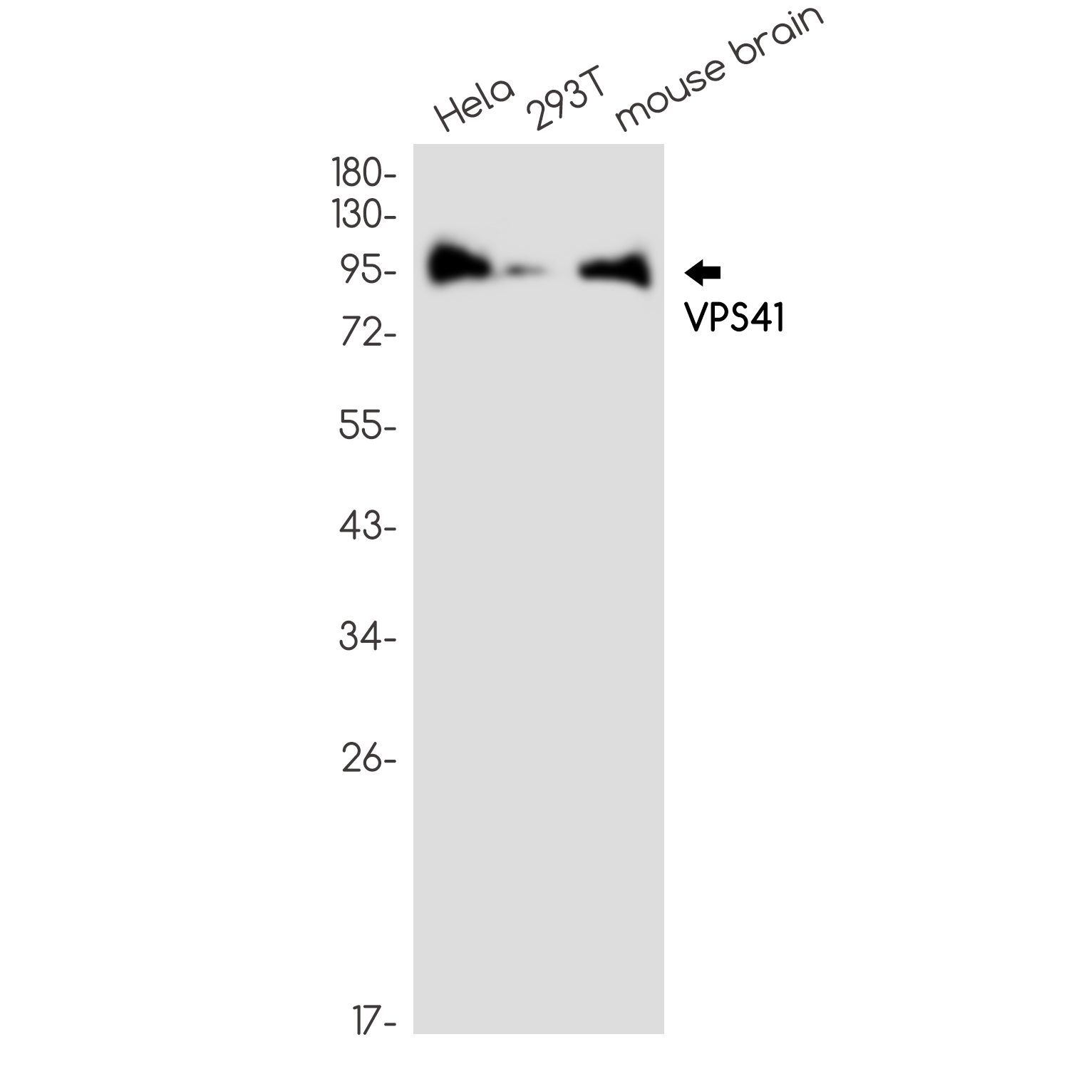 Rabbit Monoclonal Antibody to VPS41