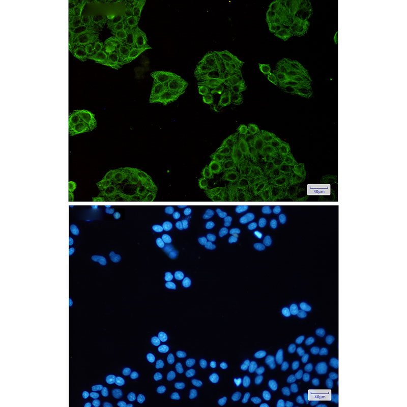 Rabbit Monoclonal Antibody to VPS4A