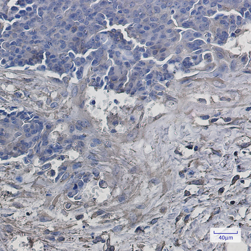 Rabbit Monoclonal Antibody to VPS4A