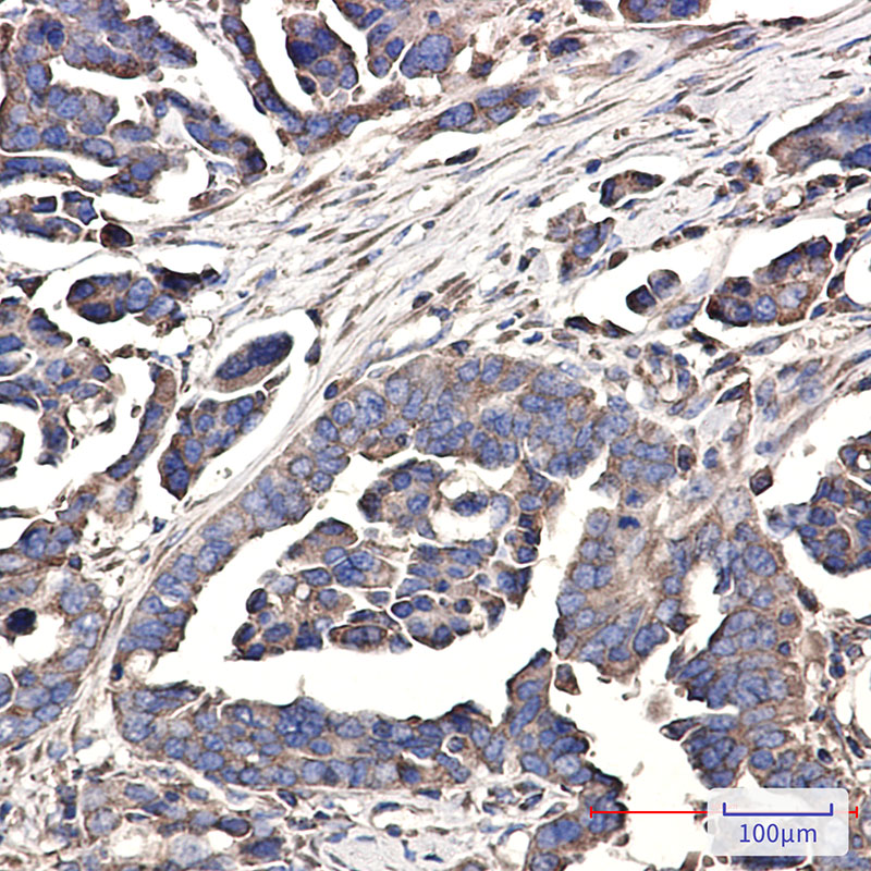 Rabbit Monoclonal Antibody to WDR1
