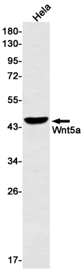 Wnt5a
