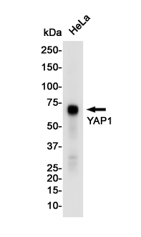 YAP1