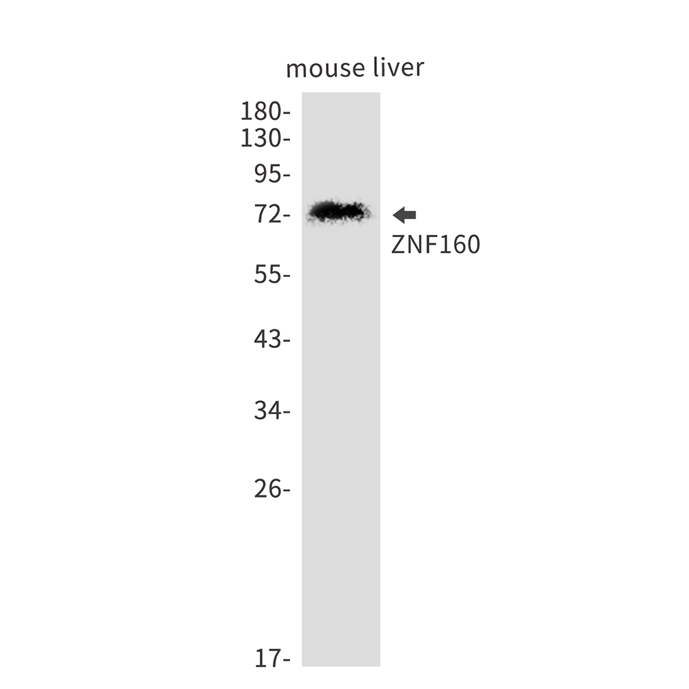 ZNF160