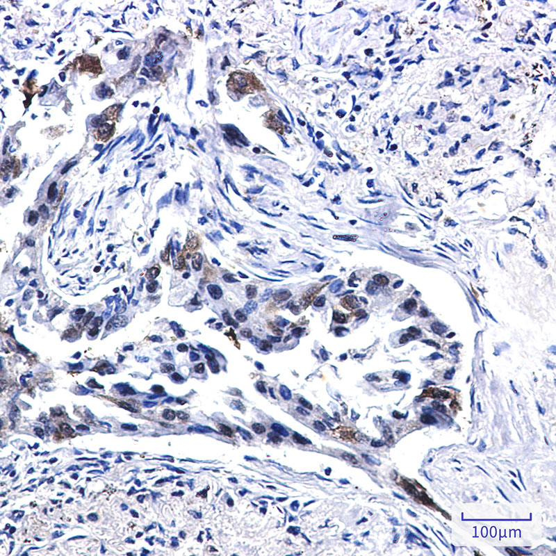 Rabbit Monoclonal Antibody to Tissue Factor