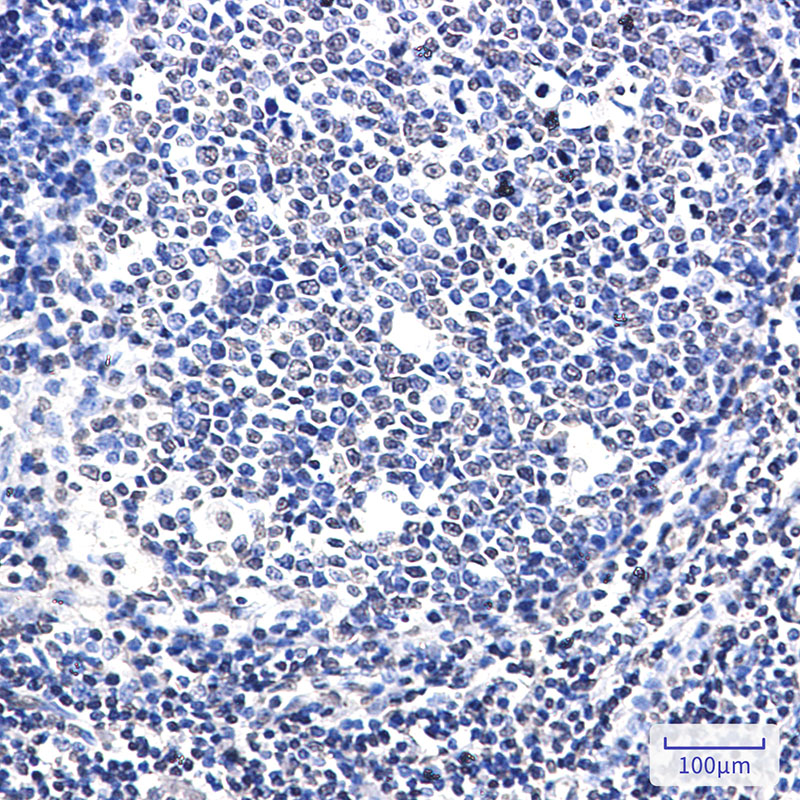 Rabbit Monoclonal Antibody to SATB1