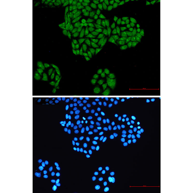 Rabbit Monoclonal Antibody to RYK