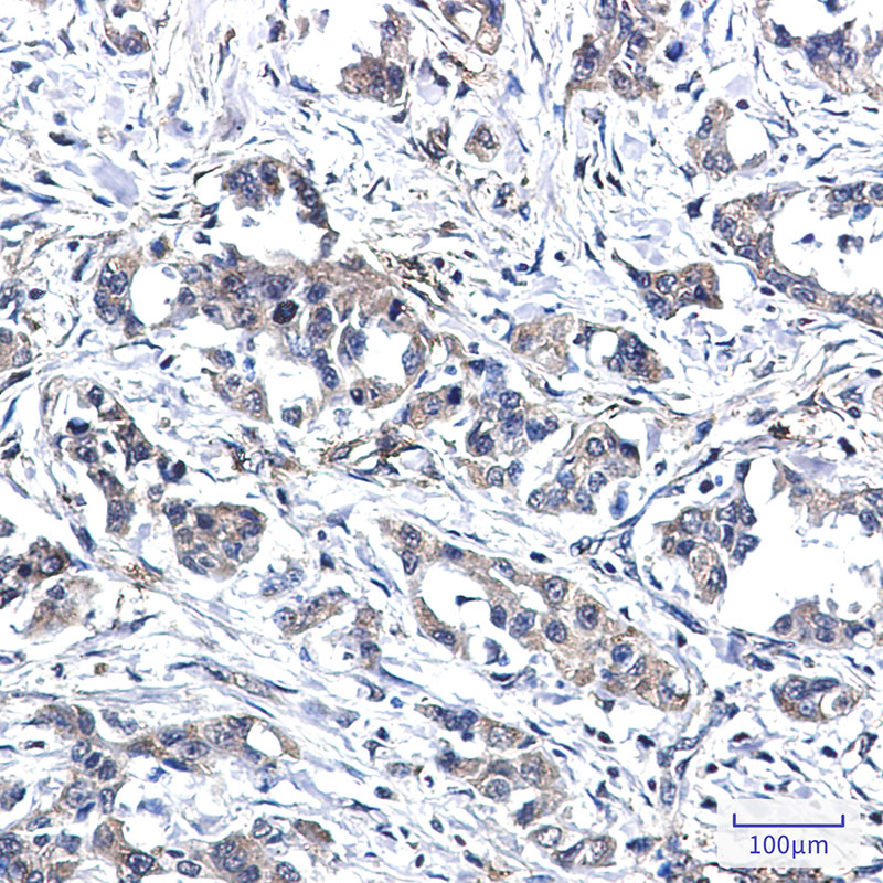 Rabbit Monoclonal Antibody to RYK