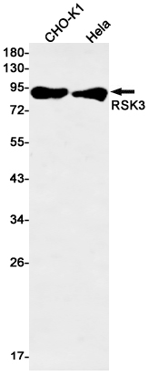 RSK3