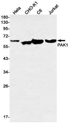 Rabbit Monoclonal Antibody to PAK1