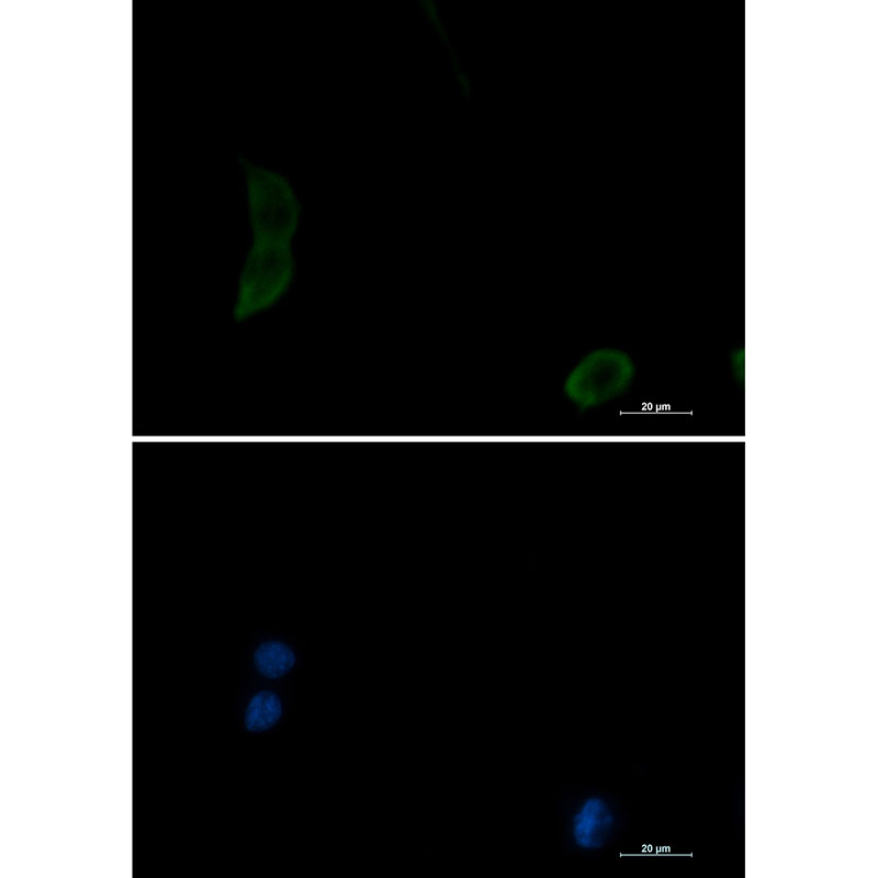 Rabbit Monoclonal Antibody to PAK1