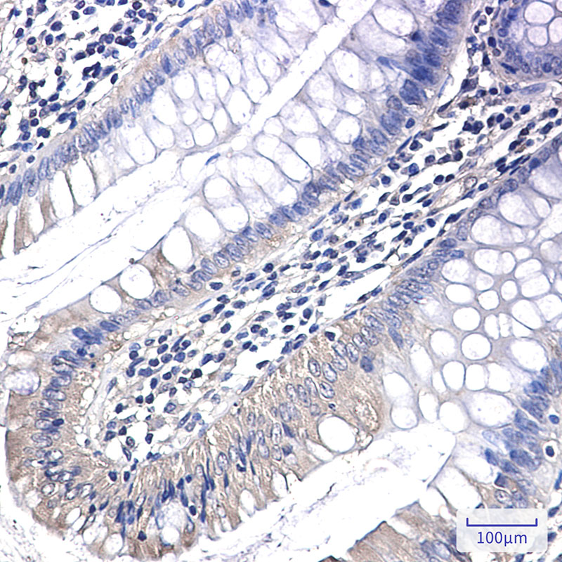 Rabbit Monoclonal Antibody to PAK1
