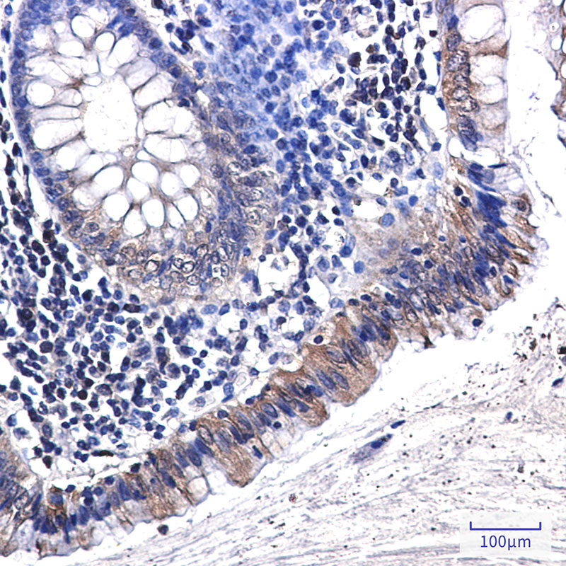 Rabbit Monoclonal Antibody to Osteopontin