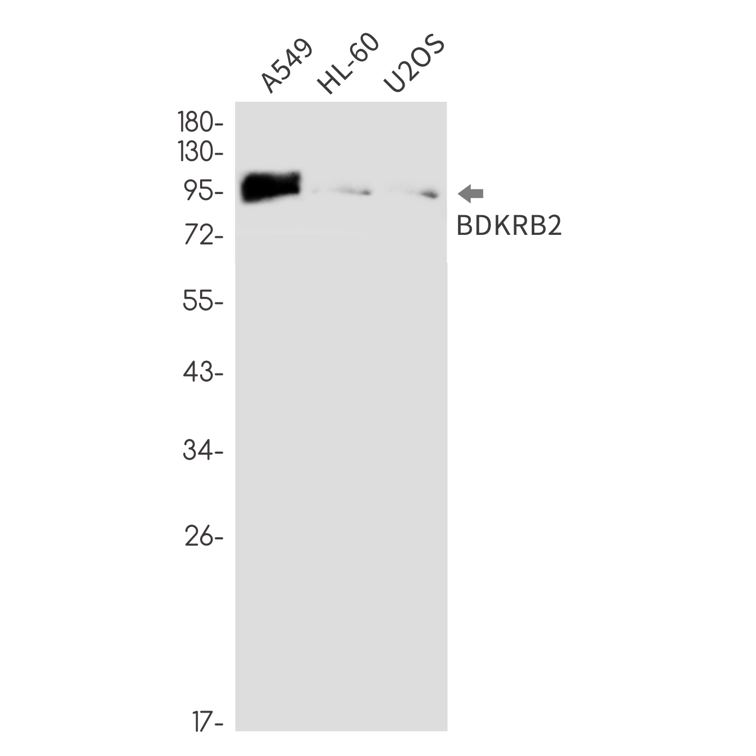 BDKRB2