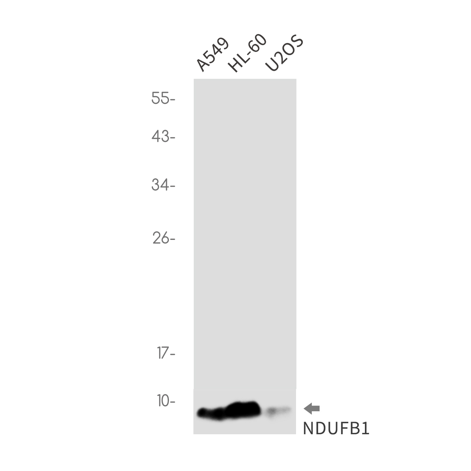 NDUFB1