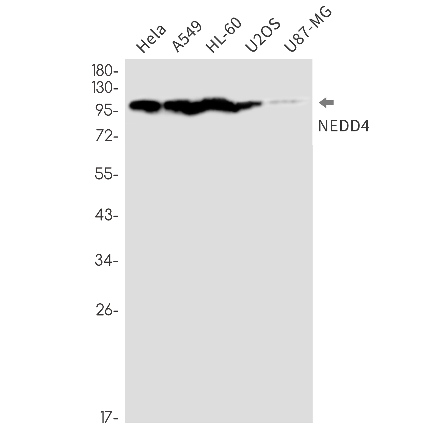 Rabbit Monoclonal Antibody to NEDD4