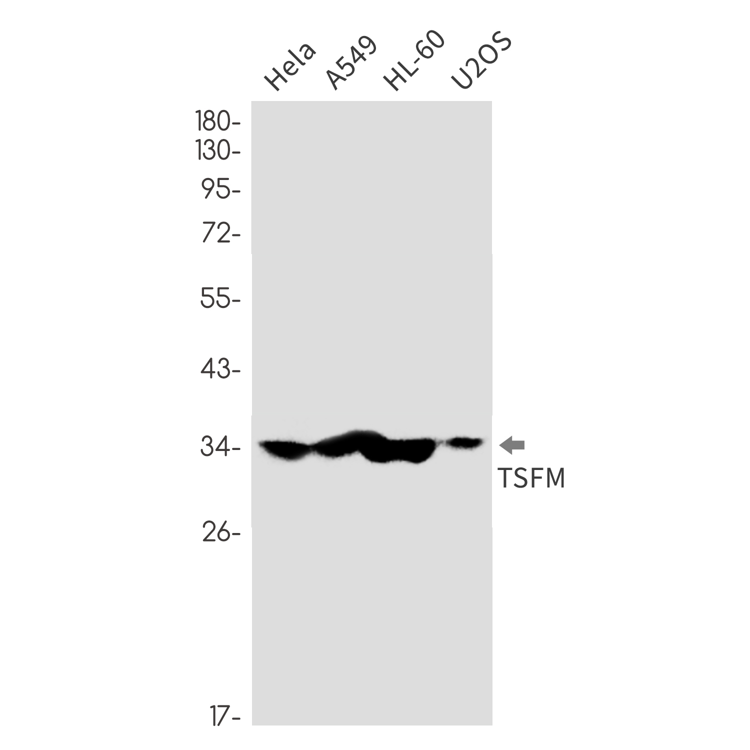 Elongation Factor Ts