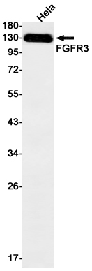 FGFR3