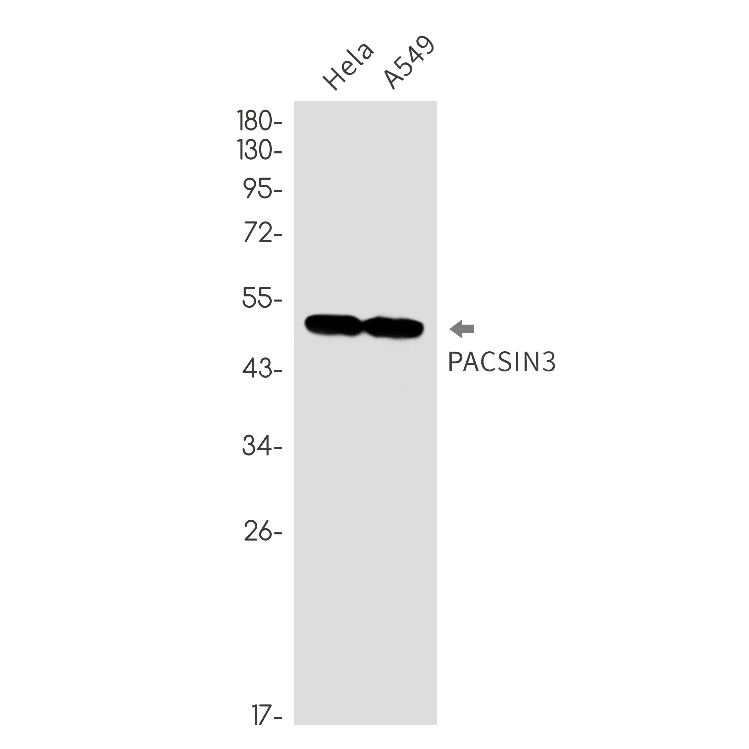 PACSIN3