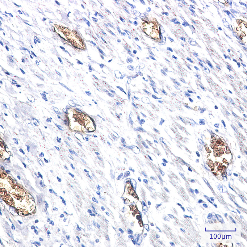Rabbit Monoclonal Antibody to PACSIN3
