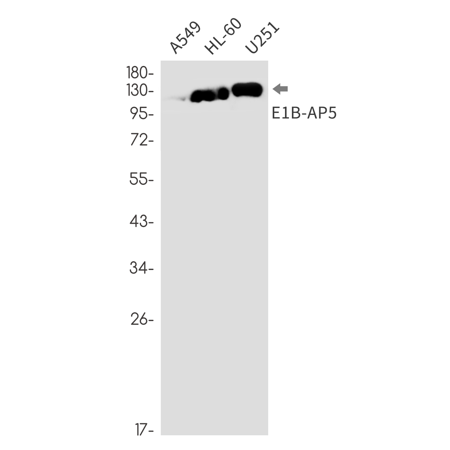 E1B AP5