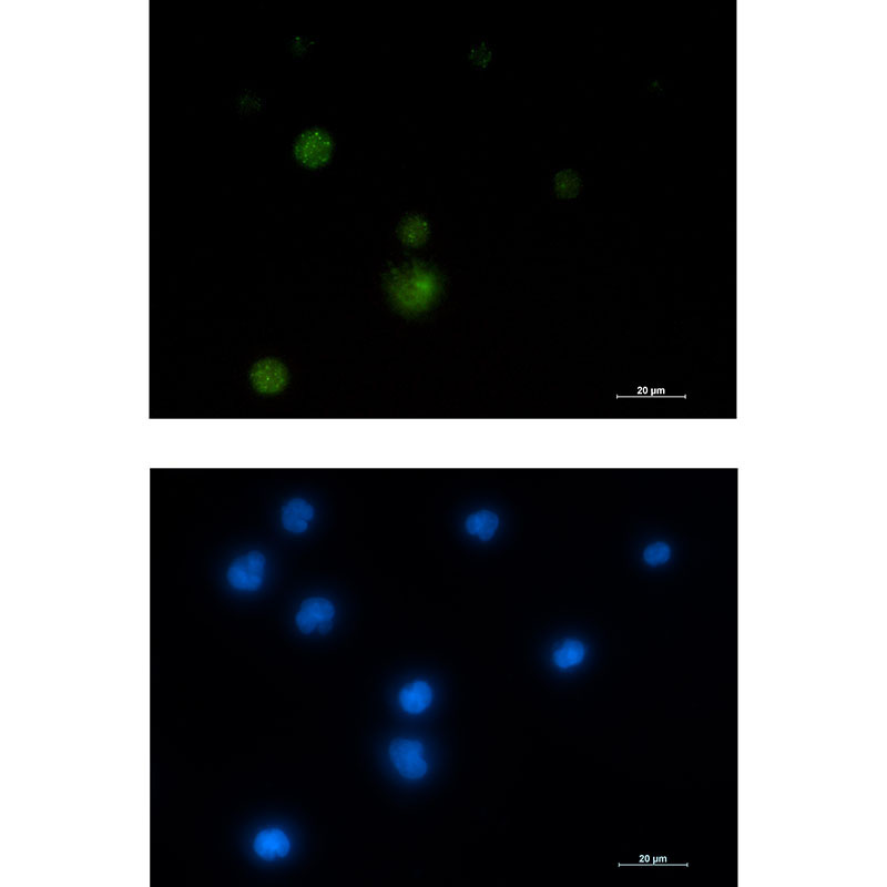 Rabbit Monoclonal Antibody to E1B AP5