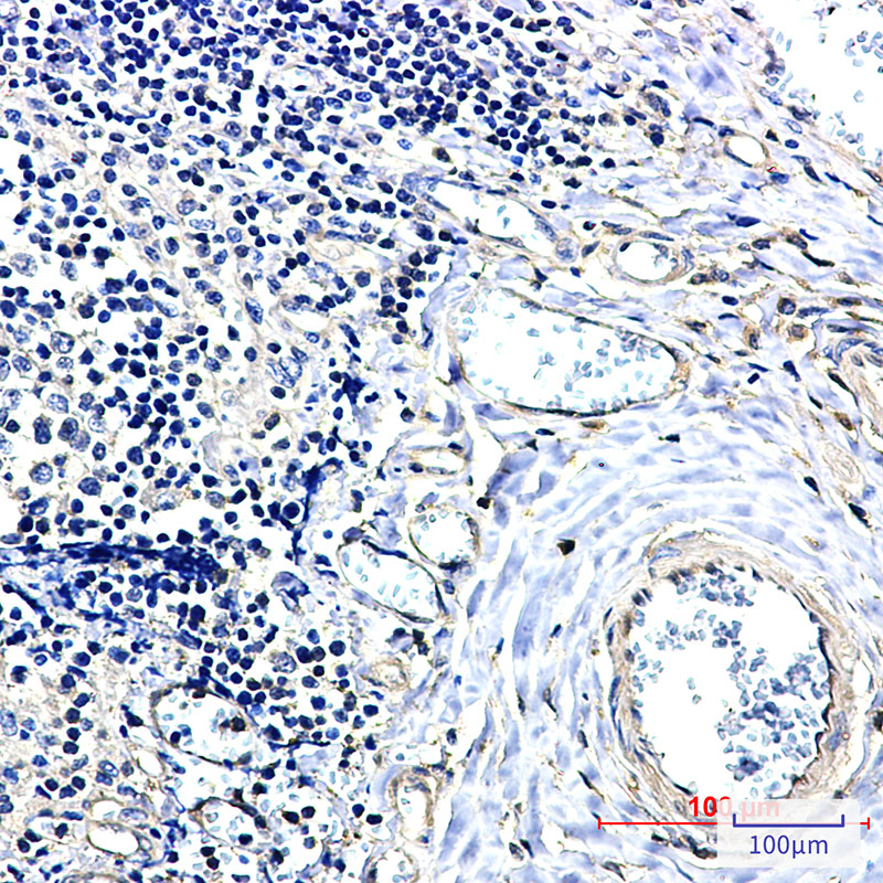Rabbit Monoclonal Antibody to 14-3-3 alpha/beta