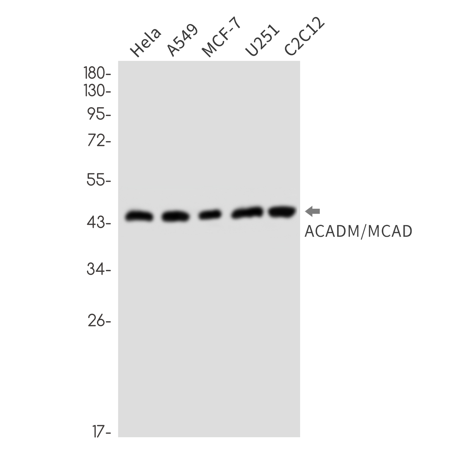 Rabbit Monoclonal Antibody to ACADM
