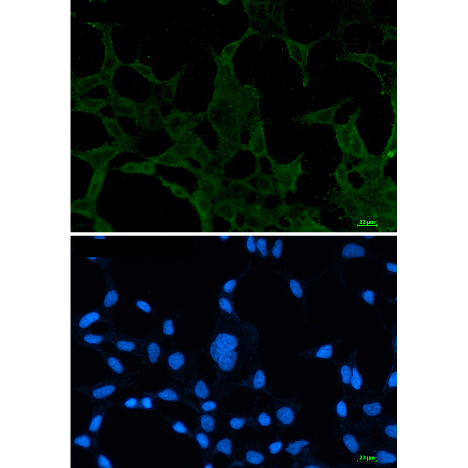 Rabbit Monoclonal Antibody to ACADM