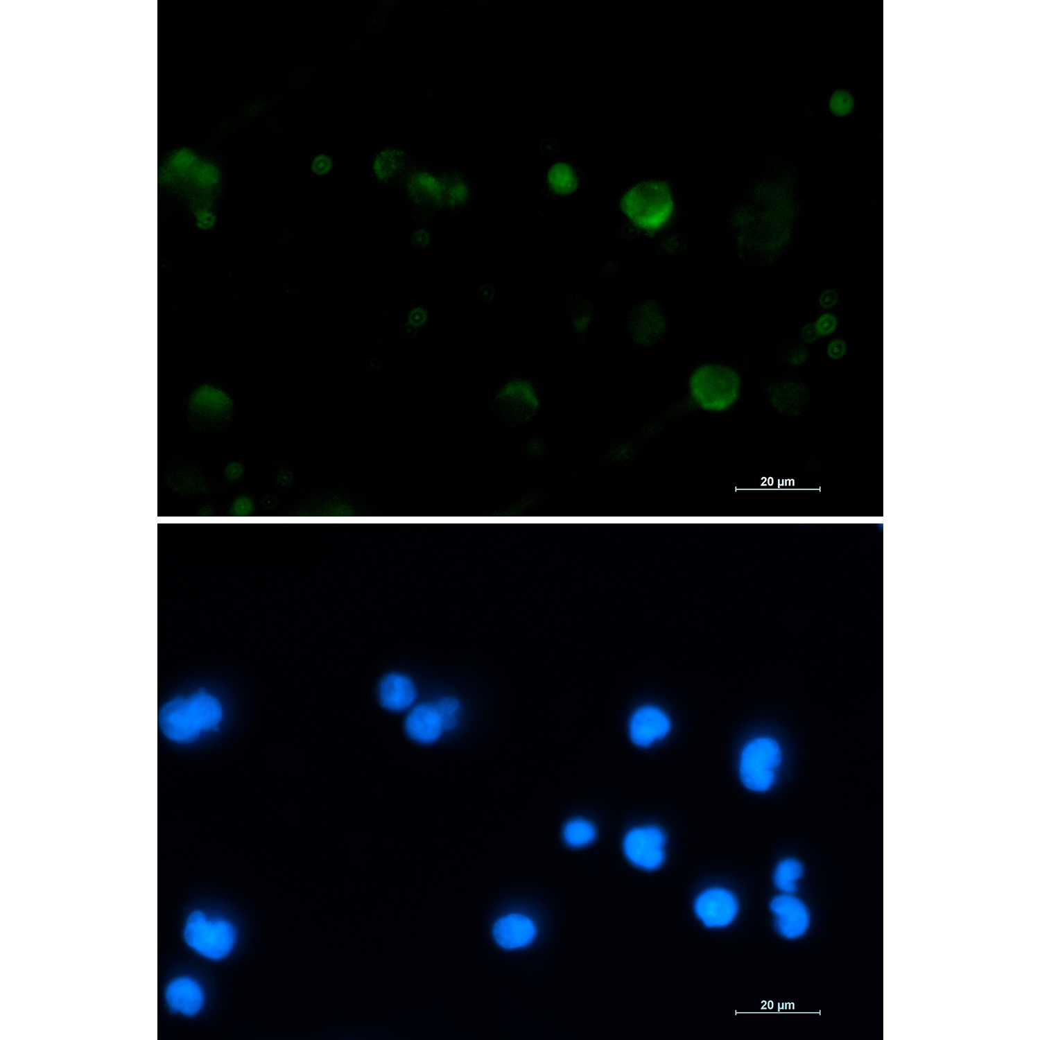 Rabbit Monoclonal Antibody to Aconitase 2