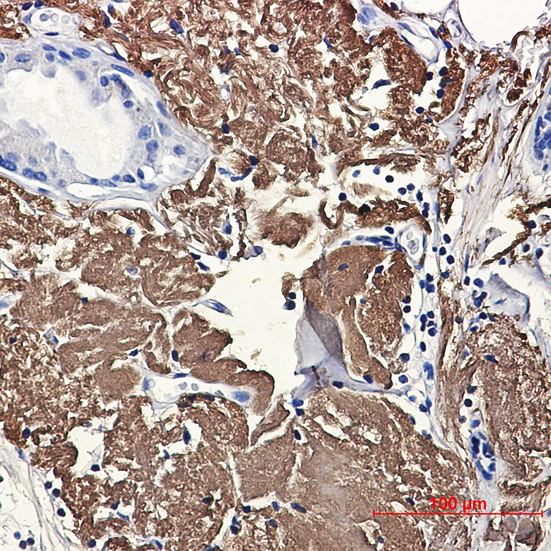Rabbit Monoclonal Antibody to Aconitase 2