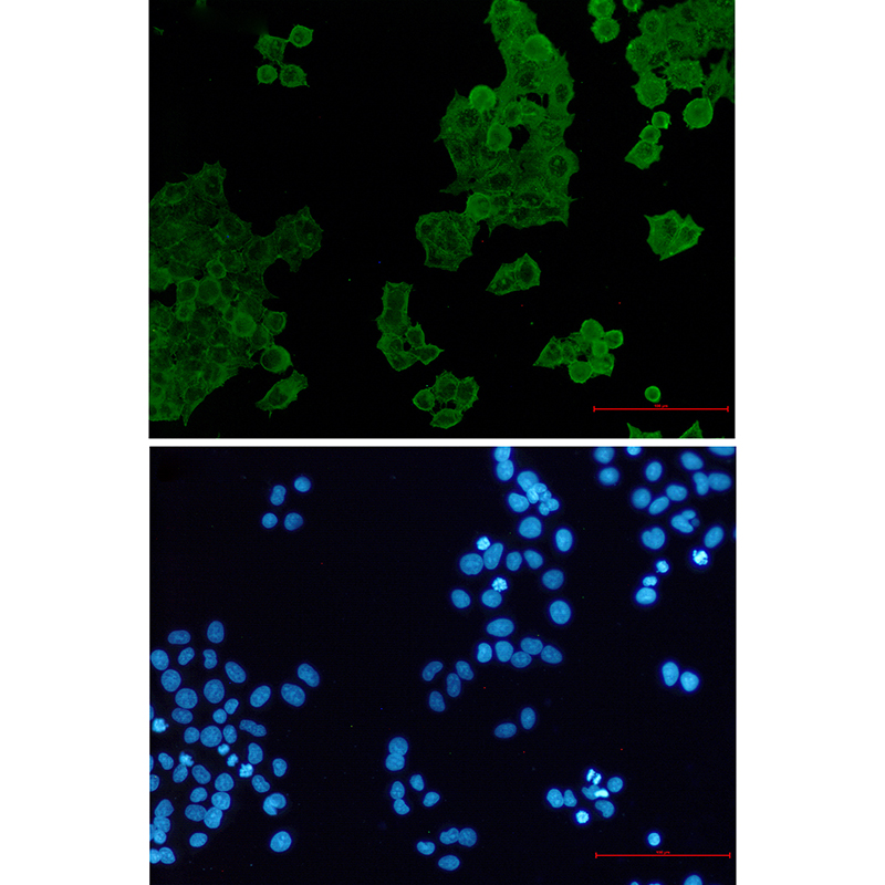 Rabbit Monoclonal Antibody to ACTR1B