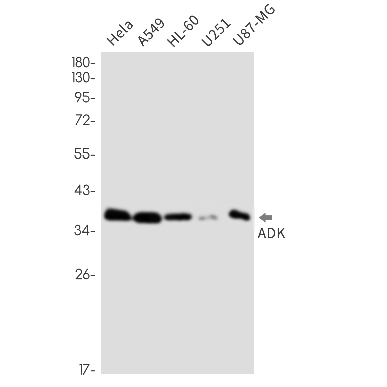 Rabbit Monoclonal Antibody to ADK