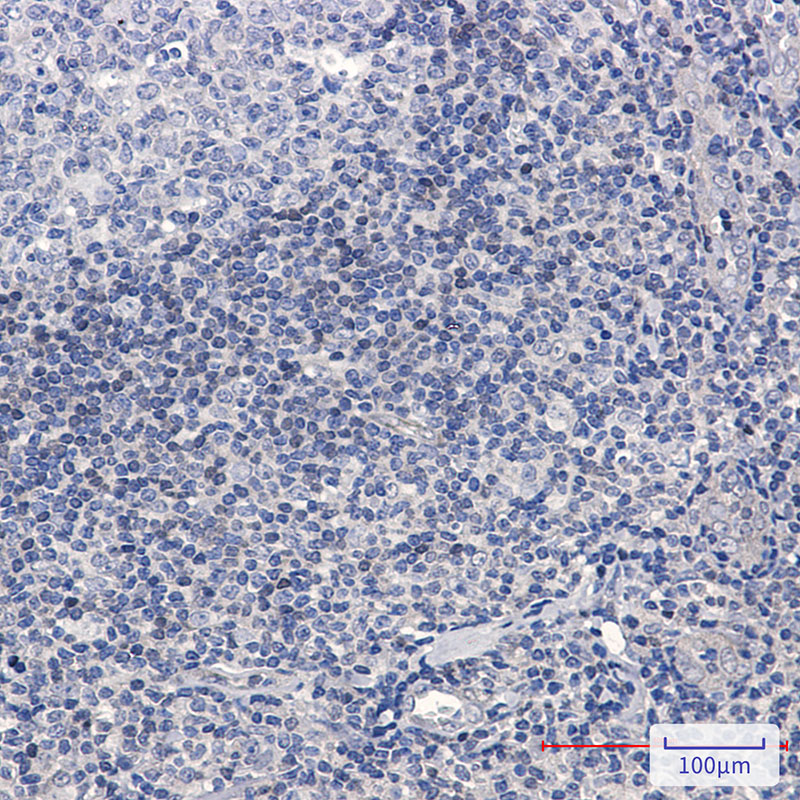 Rabbit Monoclonal Antibody to ADK