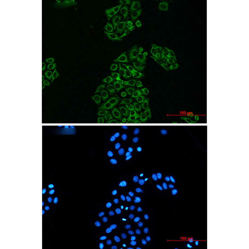 Rabbit Monoclonal Antibody to AK2