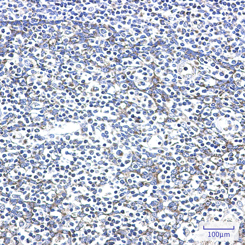 Rabbit Monoclonal Antibody to AK2